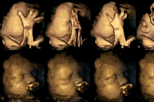 เผย! ภาพ 4D ของลูกน้อยในขณะแม่กำลังสูบบุหรี่