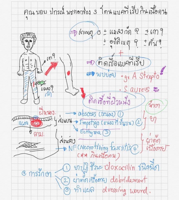 เเพทย์เเจง เเบคทีเรียกินเนื้อคนคืออะไร เป็นโรคพบบ่อย - ป้องกันได้ 