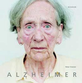 10 อาการนำโรคอัลไซเมอร์ 