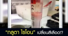 กลูตา ไธโอน เปลี่ยนสีของ เลือด จากแดงเป็นขาวได้จริงหรือ!?