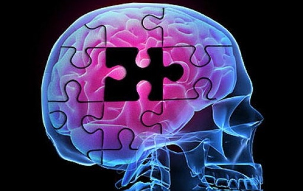 12 วิธีบริหารสมอง...จะได้ไม่เป็นอัลไซเมอร์