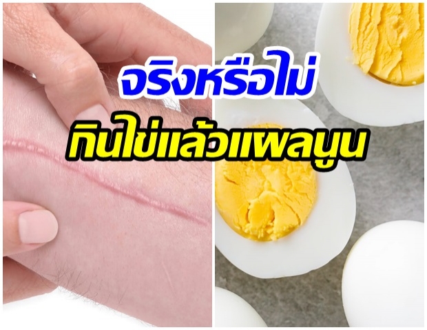 ไขข้อสงสัย? กินไข่ ทำให้เเผลนูน จริงหรือ 