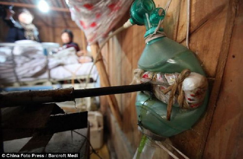 ครอบครัวจีนฝืนสู้ชะตา ประดิษฐ์เครื่องช่วยหายใจทำเองช่วยลูกชายป่วยอัมพาตรอดตาย