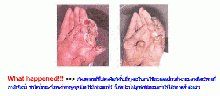 โปรดระวัง!! เจลทำความสะอาดมือ