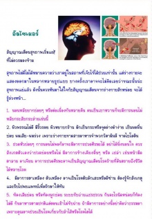 อัลไซเมอร์