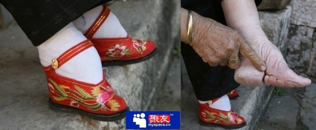 เท้าเล็ก แล้วสวย หรูหรา มีระดับ ...ค่านิยมโบราณ สาวจีน ที่สุดแสนทรมาร