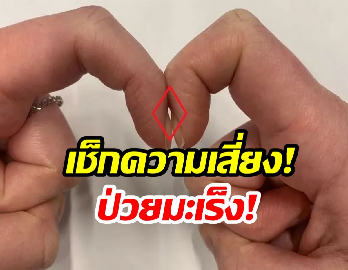 เช็กด่วน! ทำนิ้วเเบบนี้ รู้ผลมะเร็งภายใน 5 วินาที