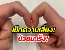 เช็กด่วน! ทำนิ้วเเบบนี้ รู้ผลมะเร็งภายใน 5 วินาที