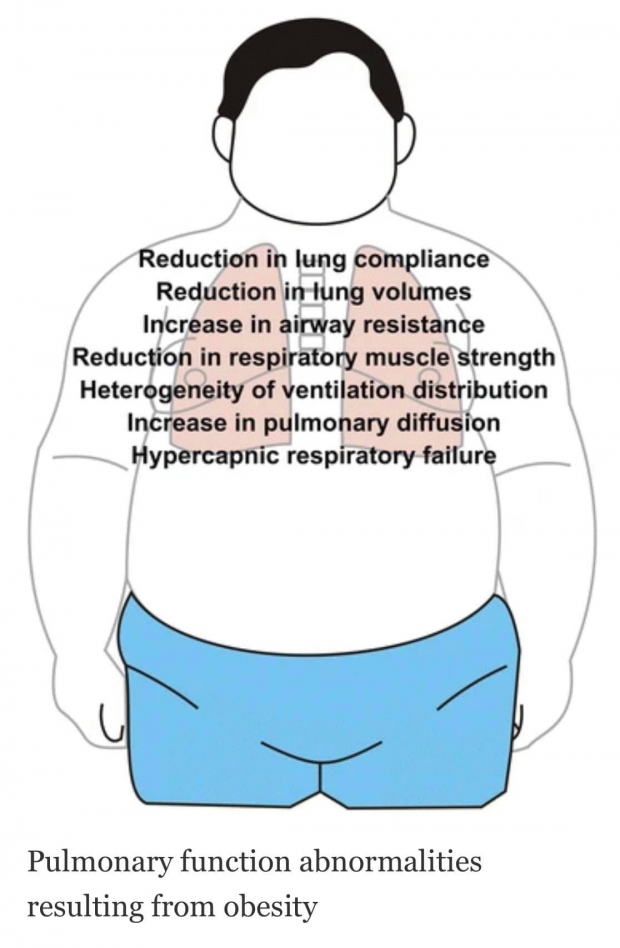 เปิดสาเหตุคนอ้วน ติดโควิด-19 ทำไมเสี่ยงสูงป่วยหนัก-เสียชีวิต