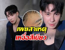 เปิดคำตอบคุณหมอ ทำไมเหงื่อ ตั้ม วราวุธ เป็นสีเขียว?