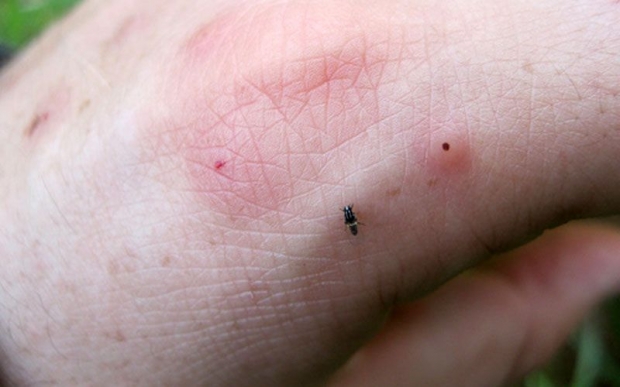 อันตรายกว่าที่คุณคิด! เตือนถูกแมลงมีพิษกัดต่อย อย่านิ่งนอนใจ-รีบพบแพทย์ด่วน
