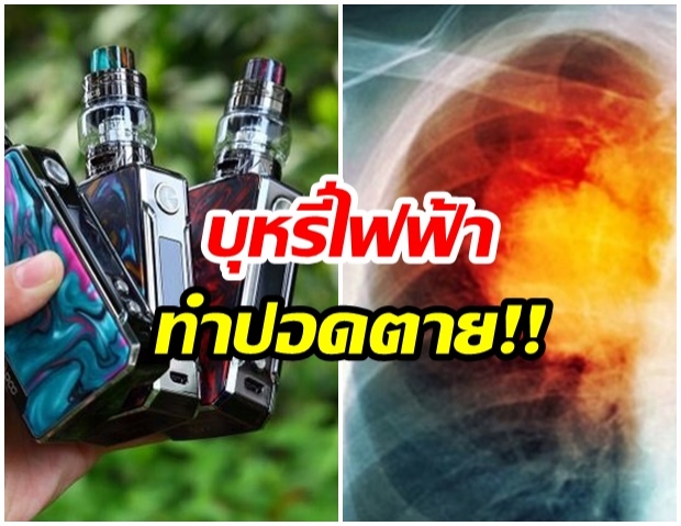 งานวิจัยออสเตรเลีย เผย ‘บุหรี่ไฟฟ้า’ ส่งผลให้เซลล์ปอดตาย