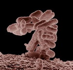 E_coli วายร้ายตัวป่วน