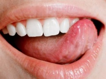 ประโยชน์ต่าง ๆ ของไหมขัดฟัน