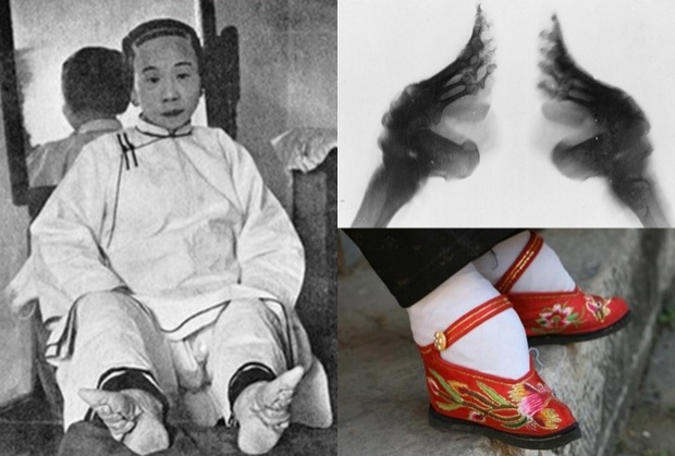 “เท้าดอกบัว” ค่านิยม ความงามสุดทรมานของ สาวจีนโบราณ
