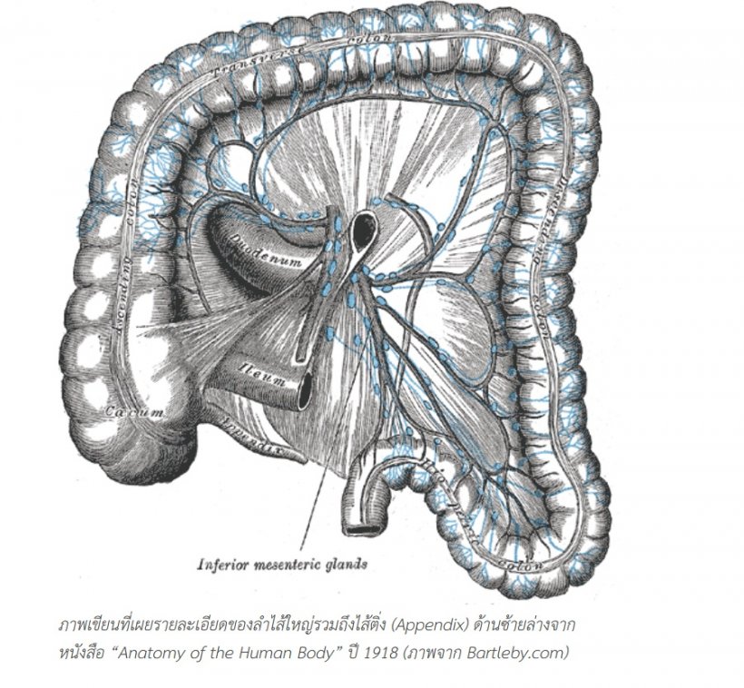 สืบจากศพ เคส “ไส้ติ่ง” พลิกวงการแพทย์ เมื่อ 300 ปีก่อน!